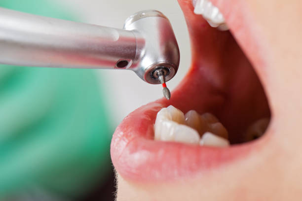 Best Emergency Gum Treatment in Ninnekah, OK